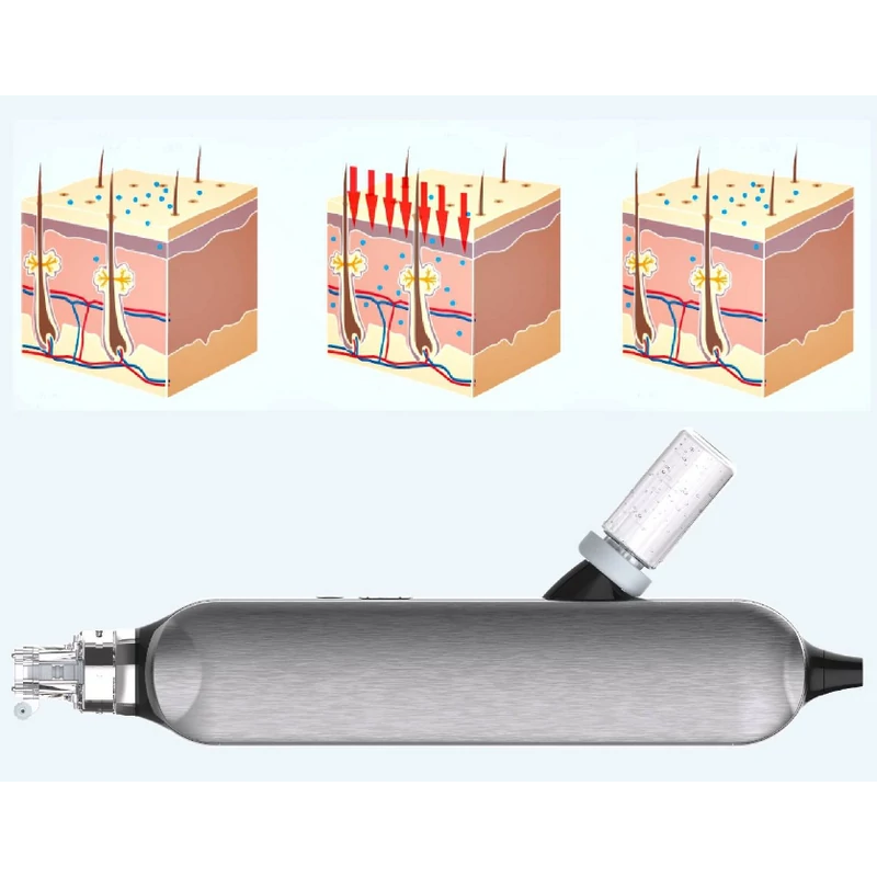HydraCrown Expert - kép 6